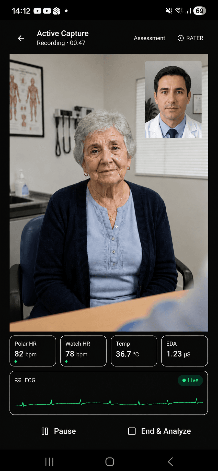 The Telephos Android app during a recording session: dual-camera view, picture-in-picture clinician, live HR / EDA / ECG biometric readouts.